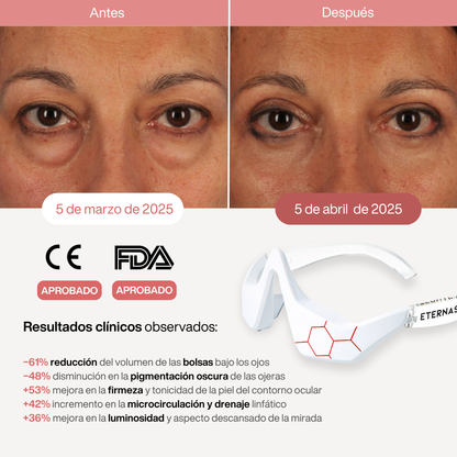 Reparador Bolsas y Ojeras con LED y Microcorriente